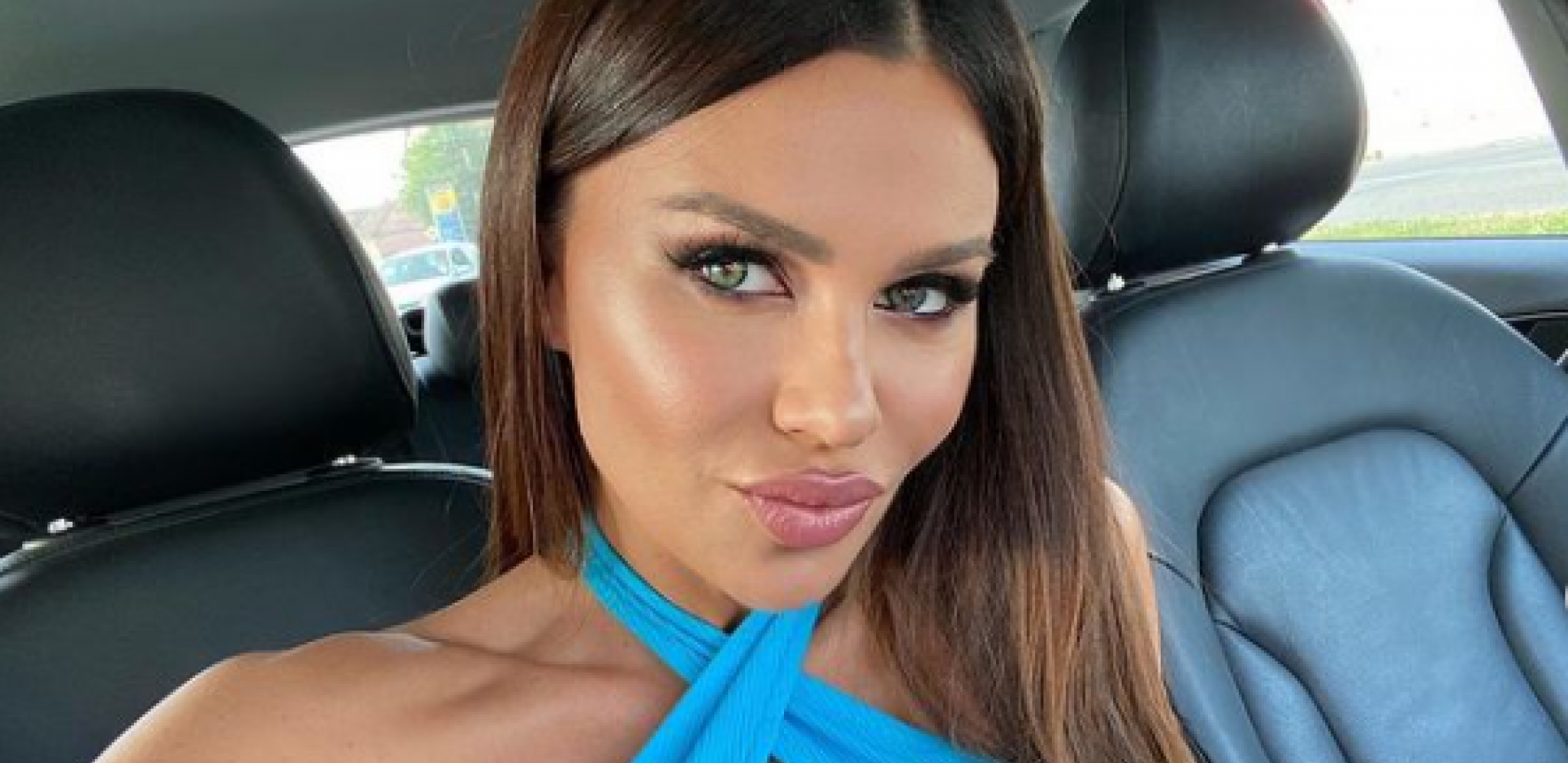 ŠTA SI TO URADILA S LICEM?! Stanija se izoperisala, ne liči na sebe! (FOTO)