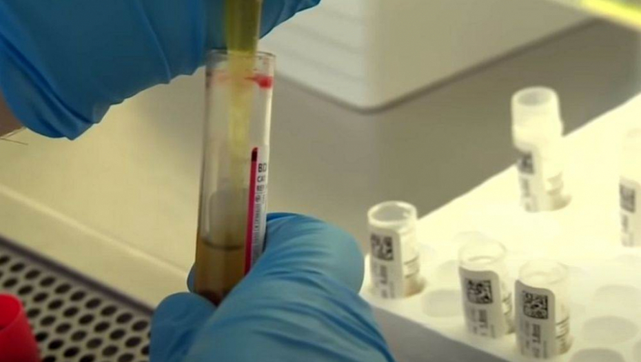 JEDNO VAĐENJE KRVI OTKRIVA KARCINOM Pronađen test koji pre pojave prvih simptoma "locira" rak i gde se nalazi