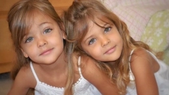 PROGLAŠENE SU ZA NAJLEPŠE BLIZNAKINJE SVETA 2010: Evo kako danas izgledaju ove čarobne devojčice