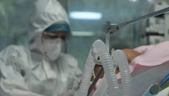 NOVI MISTERIOZNI VIRUS SE POJAVIO Gori je od KOVIDA, smrtnost je 90 odsto, a umire se u agoniji