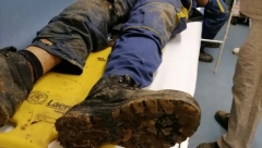 (UZNEMIRUJUĆI FOTO) POTRESNE FOTOGRAFIJE SA VMA Povređeni u eksploziji u teškim bolovima