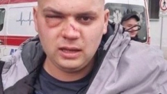 BAGERITA DUŠKO ZVERSKI PRETUČEN I UNAKEŽEN Prokiću se lekari na VMA bore za vid, a đilasovac koji ga je pretukao slavi se kao junak! (VIDEO)