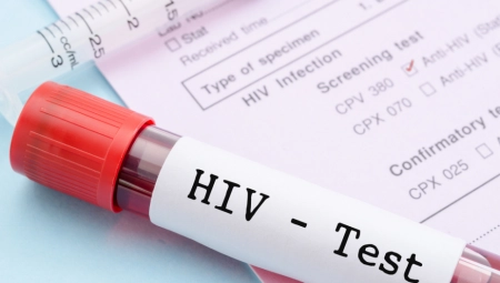 "MOJA PORODICA JOŠ UVEK NE ZNA DA SAM HIV POZITIVAN" Dečko (29) podelio je svoju priču i trenutak kada je shvatio da ima NEIZLEČIVU BOLEST!