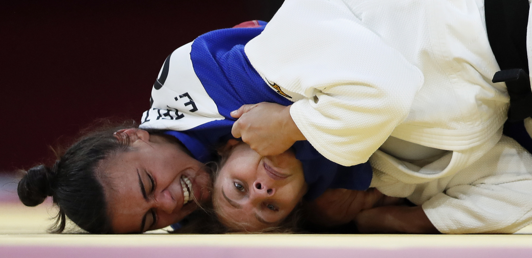STRAŠNO Muž pretukao olimpijsku šampionku, lice joj je izobličeno (UZNEMIRAVAJUĆI FOTO)