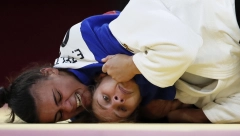 STRAŠNO Muž pretukao olimpijsku šampionku, lice joj je izobličeno (UZNEMIRAVAJUĆI FOTO)