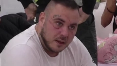 JEZIVO! MAJA NAPRAVILA NEZAPAMĆEN HAOS U ZADRUZI! Filip Car u ranama, pesničili se i šutirali u glavu, izgrebala ga po celom licu! (FOTO)
