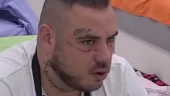 UŽAS! RAZOBLIČEN OD PODLIVA I MODRICA! Filip Car u ranama nakon tuče, evo kako izgleda sada!