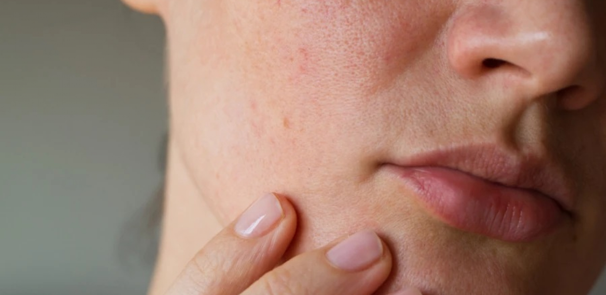SADA JE NAJVAŽNIJA HIDRATACIJA Pet saveta dermatologa za savršenu negu lica tokom zime
