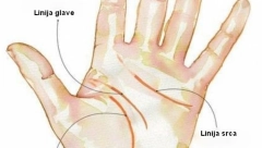 PROČITAJTE SA DLANA Ovaj znak otkriva kakvog ste zdravlja