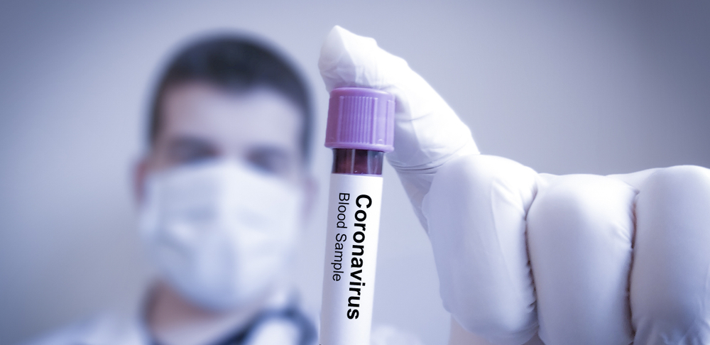 NOVI SOJ STIGAO IZ VELIKE BRITANIJE U Severnoj Makedoniji registrovan prvi slučaj omikrona