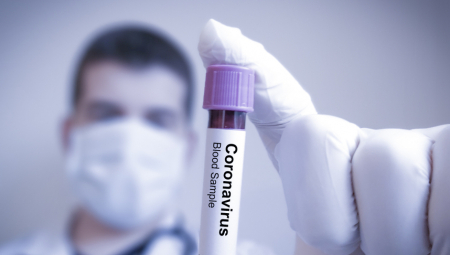 SZO UPOZORAVA Još tri teška meseca, ali kraj pandemije na vidiku!