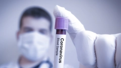 SZO UPOZORAVA Još tri teška meseca, ali kraj pandemije na vidiku!