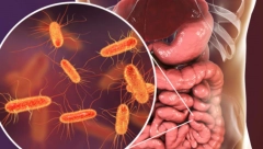 ZDRAVLJE DOLAZI IZ DEBELOG CREVA Ovi simptomi mogu da ukažu na opaku bolest, a mogu da budu i bezazleni, jedna stvar je od presudne važnosti