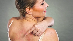 DVA SIMPTOMA SU KLJUČNA Da li ste alergični na zimu?