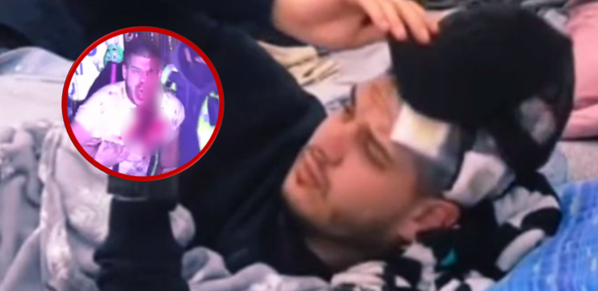 PRETE MU OZBILJNE ZDRAVSTVENE KOMPLIKACIJE?! Isplivao jeziv snimak Dejana koji vadi staklo iz glave, gledaoci zabrinuti! (VIDEO)