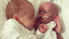 PRERANO ROĐENI DEČAK SE BORI ZA ŽIVOT: Zastaće vam dah kad vidite šta njegov brat blizanac radi za njega