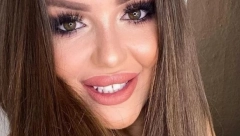 VIŠE NE IZGLEDA OVAKO Najstarija sestra Rodić doživela neviđenu transformaciju, vratila je prirodne usne i potpuno je neprepoznatljiva (FOTO)