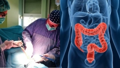 DŽABA NAM DIJETE AKO IMAMO OVO U CREVIMA Čuvena doktorka otkrila šta nas deblja