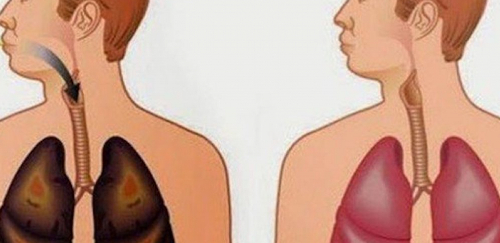 ČISTA PLUĆA ZA SAMO 3 DANA Uz pomoć ovih sokova, izgledaće kao da nikada niste zapalili cigaretu