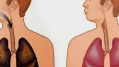 ČISTA PLUĆA ZA SAMO 3 DANA Uz pomoć ovih sokova, izgledaće kao da nikada niste zapalili cigaretu