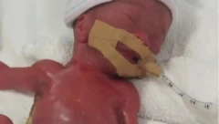 OVA BEBA JE SVIMA INSPIRACIJA: Rođena kao najmanja na svetu, provela je 13 meseci u bolnici i sada je krupno dete - njen oporavak je oduševio lekare