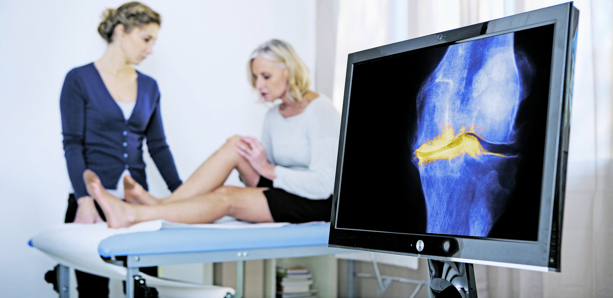 MUKE TANTALOVE Šta je to gonartroza, kako se dobija i kako najlakše da se izleči