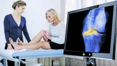 MUKE TANTALOVE Šta je to gonartroza, kako se dobija i kako najlakše da se izleči