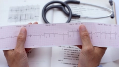 KARDIOLOZI OTKRIVAJU Rizik od infarkta imaju ljudi sa ovim krvnim grupama