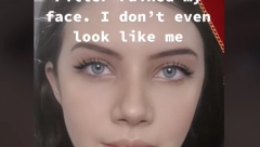 LICE JOJ SE IZOBLIČILO Ova lepotica je filere prvi put stavila sa 20 godina, a sada izgleda NEPREPOZNATLJIVO (FOTO, VIDEO)!