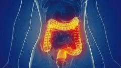 IZBACITE OTROVE IZ ORGANIZMA: Ovo su simptomi toksičnog debelog creva, a ono je uzrok raznim bolestima