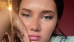 IMA SAMO 25 GODINA A LICE JOJ JE VEĆ UNIŠTENO OD BOTOKSA Pet godina već ubrizgava filere koji su joj deformisali facu