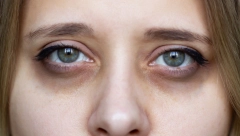 U OČIMA SE MOGU PRIMETITI I NAJTEŽE BOLESTI: Ako vidite ove znakove, javite se lekaru dok ne bude kasno