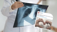 URADITE BRZI TEST SA KAŽIPRSTOM Saznajte da li bolujete od raka pluća ili Kronove bolest