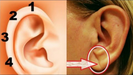 SVAKOG DANA JE ŠTIPALJKOM PRITISKALA UVO: Žena je zanemela kada je videla rezultate, bolovi su nestali u trenu