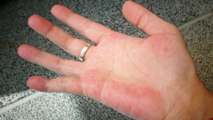 KINESKA TRADICIONALNA METODA LEČENJA: Proverite svoje zdravstveno stanje pomoću dlanova i stopala