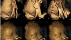 MAME, OPREZ! Nakon ovog snimka ćete dobro da razmislite da li ćete zapaliti cigaretu kada se u vašem organizmu razvija novi život