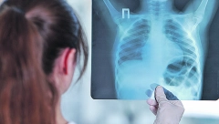 SPAS ZA PUŠAČE Ovaj napitak momentalno čisti pluća, a recept je vrlo jednostavan