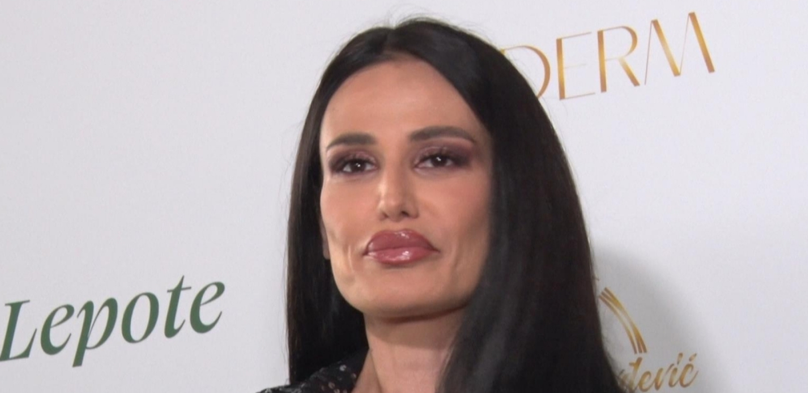 OSTALA SAM BEZ SLEZINE Indi je nakon operacije želuca prošla kroz pakao, težak period ostavio je posledice, a sada je otkrila mučne detalje