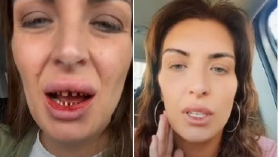 ZBOG JEFTINIJEG OSMEHA ŽIVOT JOJ SE PRETVORIO U PAKAO  Devojka otišla u Tursku po nove zube, vratila se unakažena i u nepodnošljivim bolovima