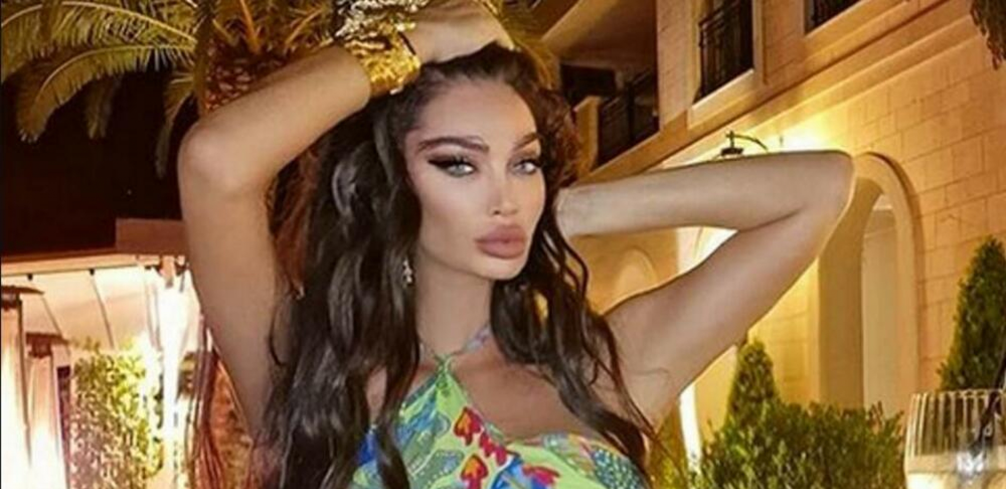SORAJA SVA U MODRICAMA Šok objava starlete, fotografije se šire mrežama, lice izobličeno (FOTO)