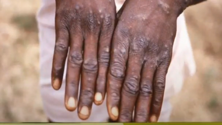 "BATUT" OBJAVIO UPUTSTVO O MAJMUNSKIM BOGINJAMA U njemu se ističe da one nikada nisu zabeležene kod nas