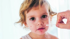 ZARAZA NE PRESTAJE DA SE ŠIRI Na meti deca do dve godine