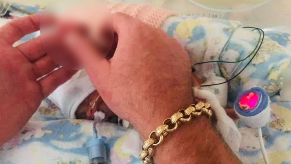 MISLILI SU DA NEĆE PREŽIVETI Beba rođena u 23 nedelji, imala je manje od 500 grama, a njena šaka je bila veličine nokta njenog oca (FOTO)