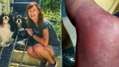 ISPOVEST VODITELJKE KOJI VODI BORBU SA POSTKOVID SINDROMOM: Živela je zdrav život, a evo zbog čeka sada ne može da ustane sa stolice