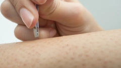 URASLA DLAČICA NA TELU MOŽE DA DOVEDE DO OPERACIJE Doktor otkriva trik zahvaljujući kome nikada nećete imati problem!