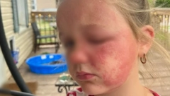 DEVOJČICA (6) UMALO UMRLA ZBOG OTROVNE BILJKE Raste u srpskim dvorištima, izgleda kao korov, a ustvari je smrtonosna