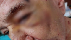 "MOJ OTAC JE DVA PUTA PRETUČEN U STARAČKOM DOMU U OBRENOVCU" Oglasila se ćerka čoveka koji je doživeo nasilje (FOTO)