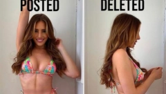 NE STIDITE SE SVOG TELA Manekenka se skinula i pokazala svoje nesavršenosti, evo kako izgledaju njene fotografije bez fotošopa