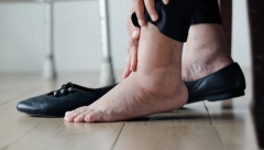 DA LI VAM OTIČU NOGE? Stari narodni napitak momentalno pomaže, od ovoga ne postoji ništa bolje