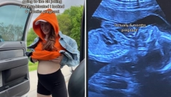 SKRIVENA TRUDNOĆA Mislila je da ima problem sa gasovima, kada je otišla kod lekara, ostala je šokirana!